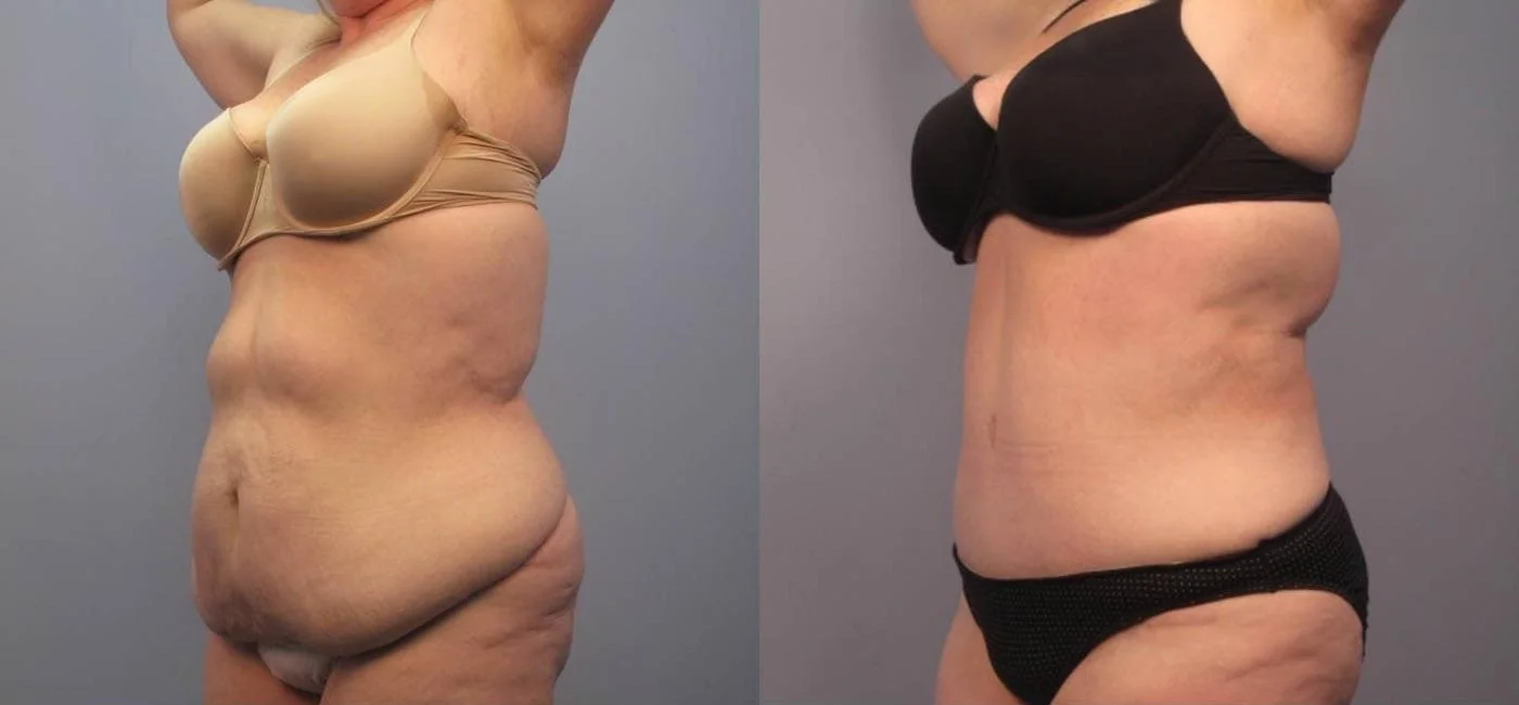 what exactly does tirzepatide do New Weight Loss Medical Advances. Exploring Tirzepatide Products | by James  J Busby
