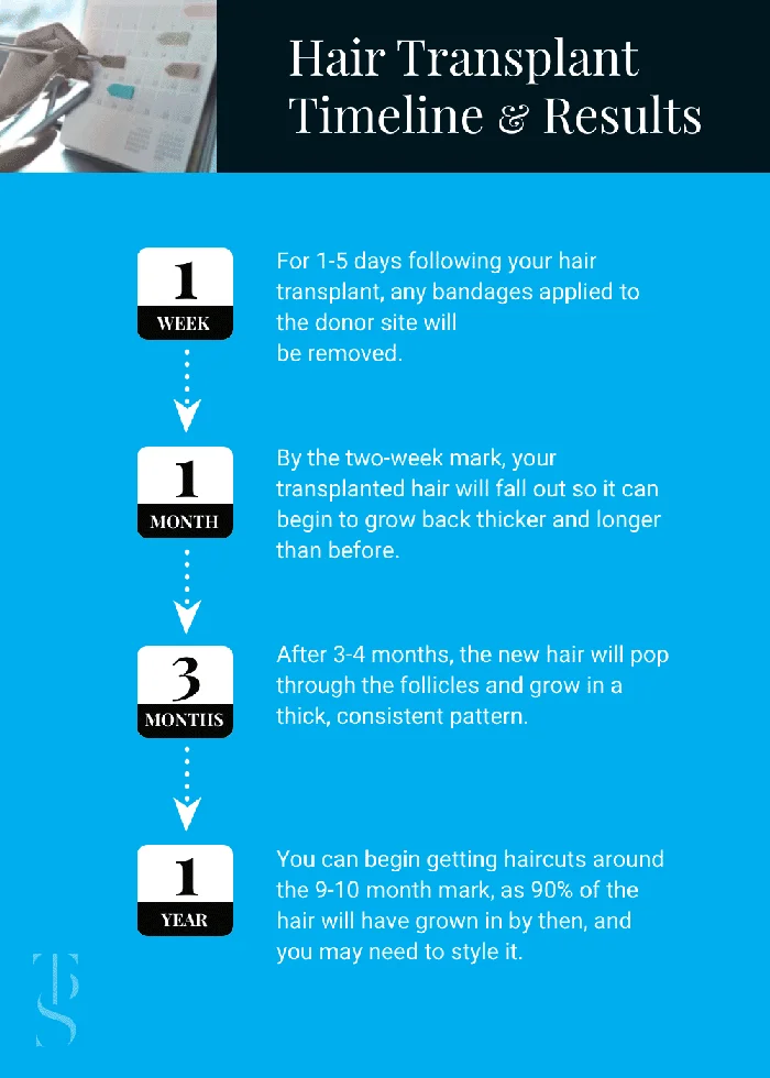 Timeline of Results of Hair Transplants