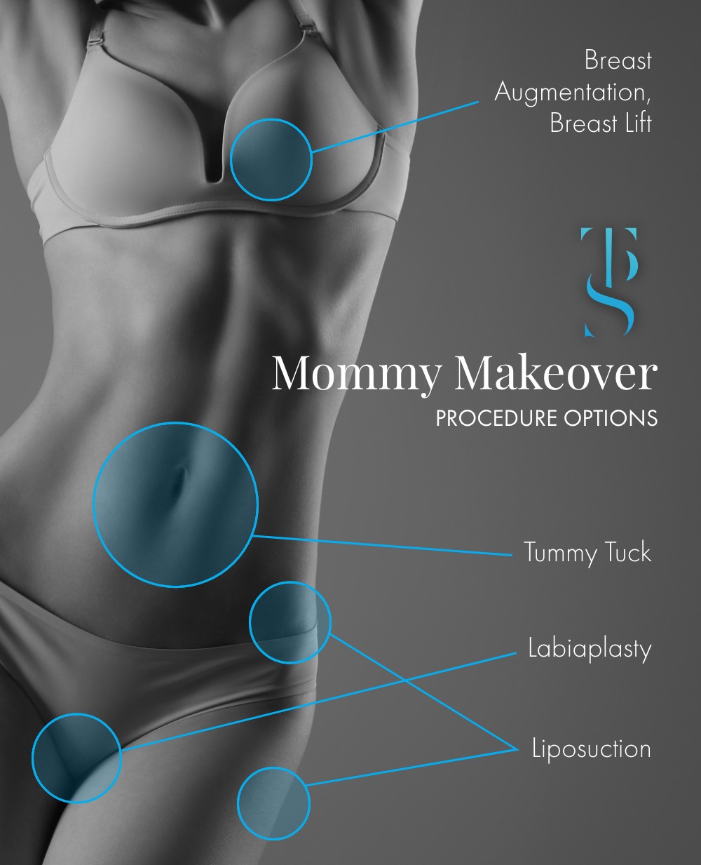 Procedures Included in a Mommy Makeover